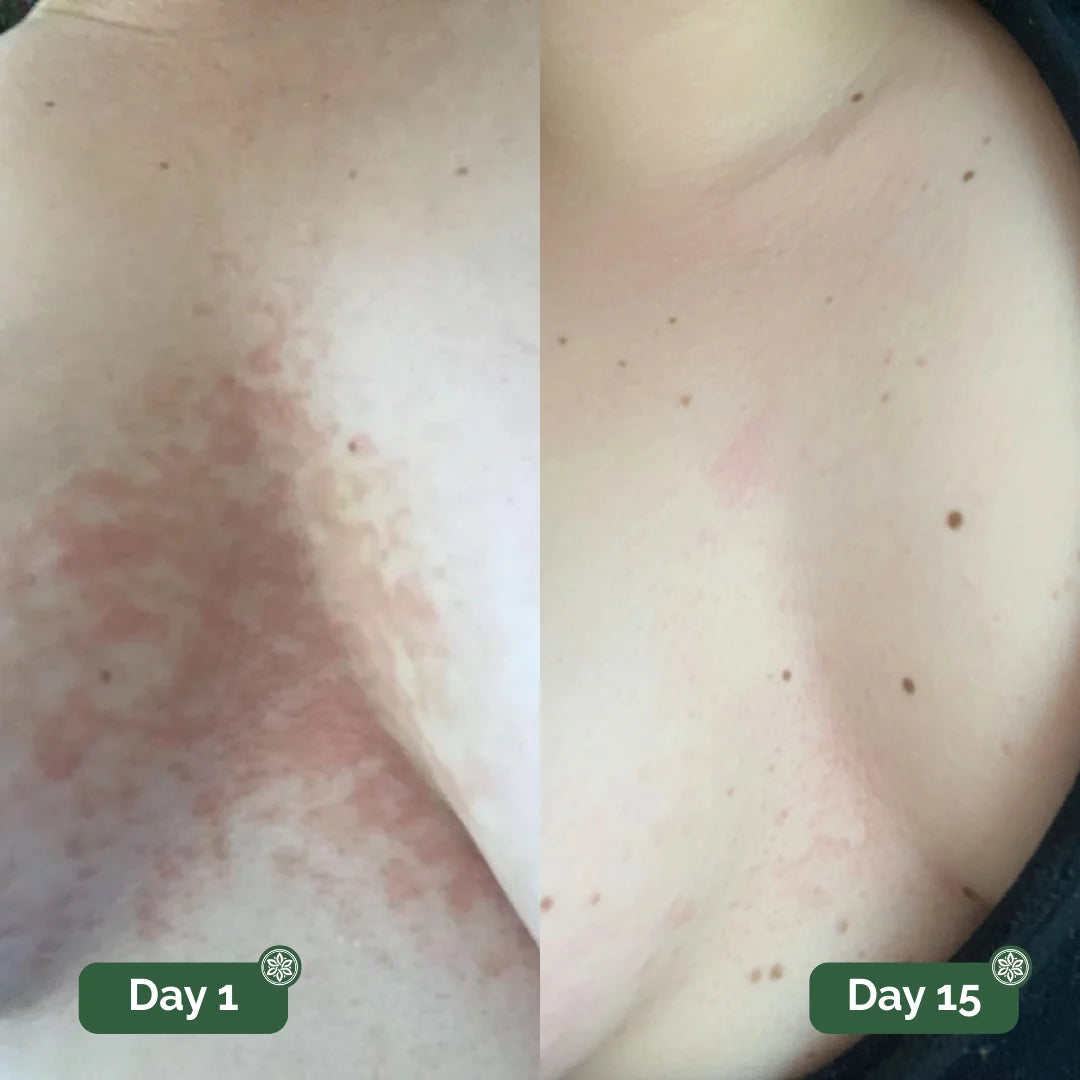 Hyde™ Antifungal Soap