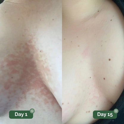 Hyde™ Antifungal Soap