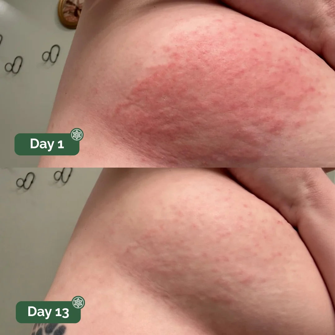 Hyde™ Antifungal Soap