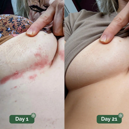 Hyde™ Antifungal Soap